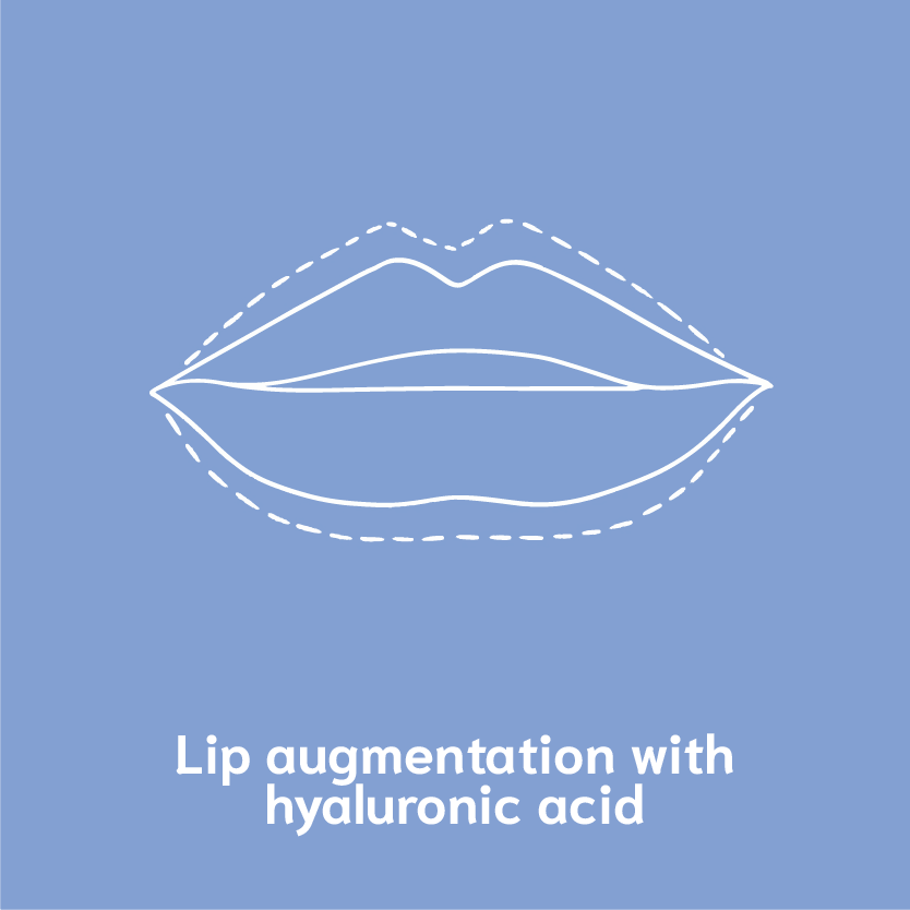 lip augmentation with hyaluronic acid