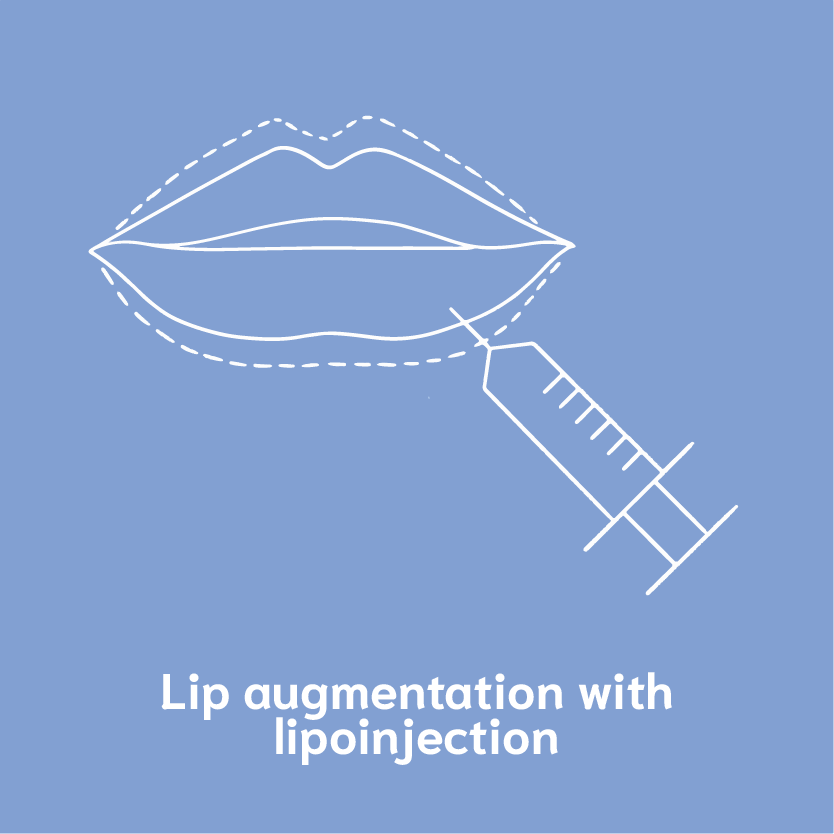 lip augmentation with lipoinjection