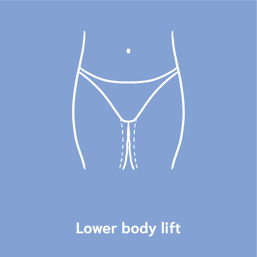 lower body lift