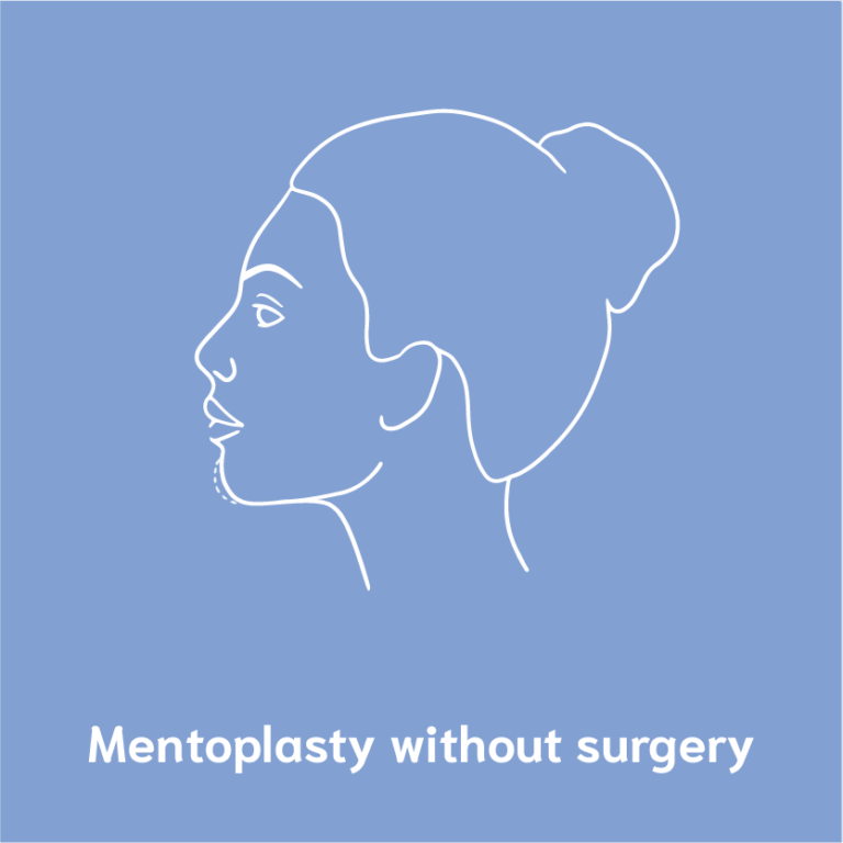 mentoplasty without surgery