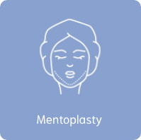 Mentoplasty