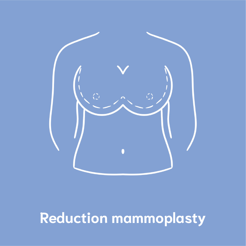 rreductionnn mammplasty