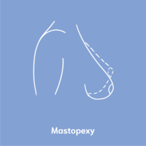 mastopexy