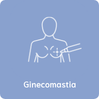 cirugia de ginecomastia para hombres