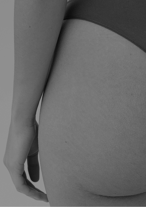 gluteos