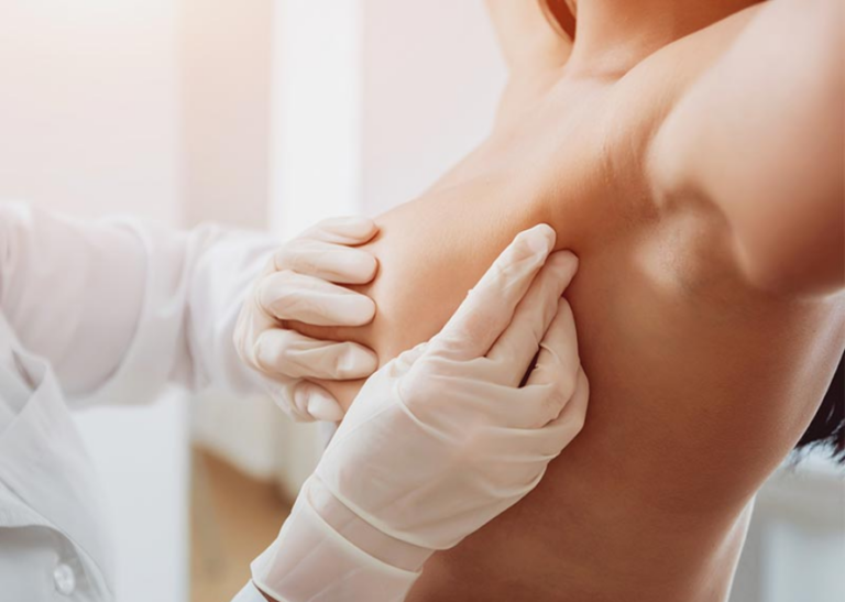 mamoplastia - aumento mamario