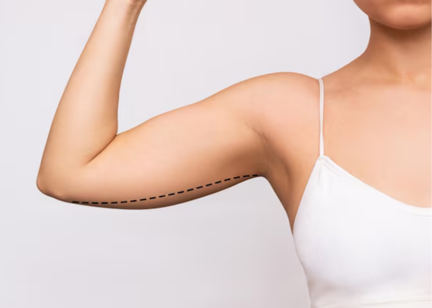 braquioplastia