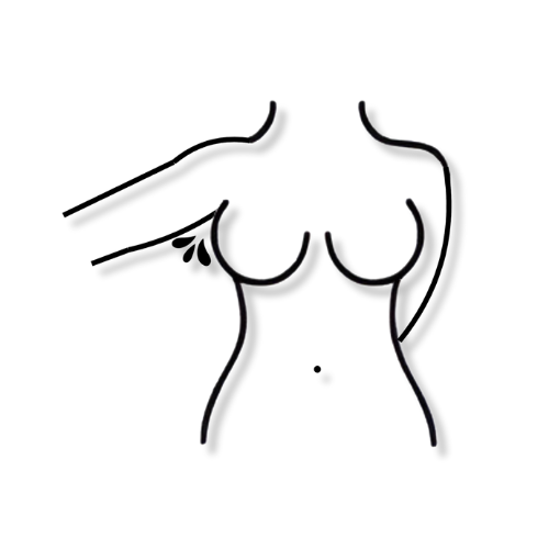 correccion de hiperhidrosis