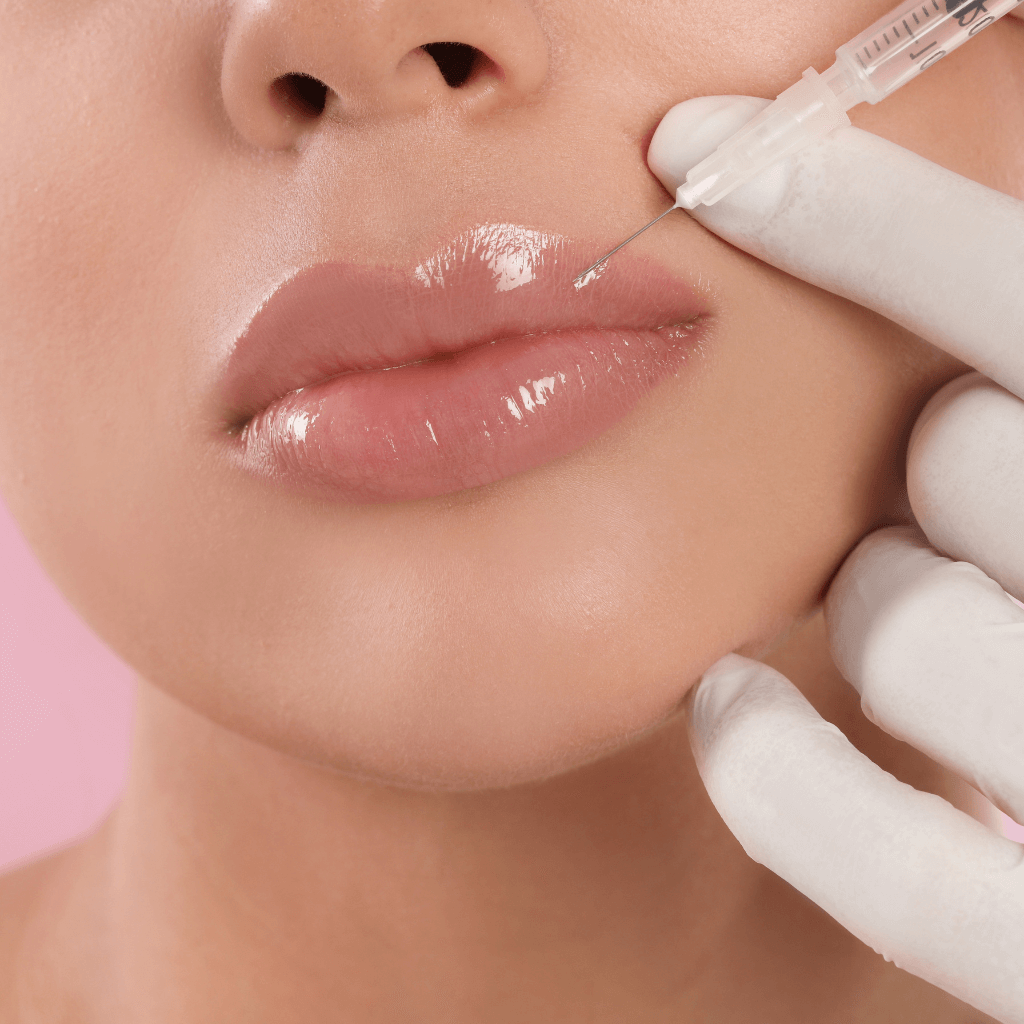 labios con acido hialuronico jose cortes