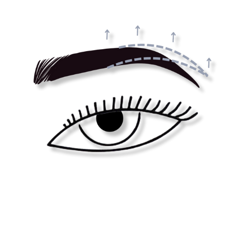 lifting de cejas
