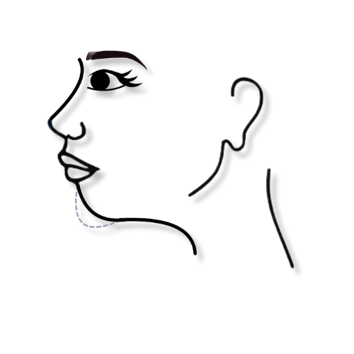 menoplastia sin cirugia icono
