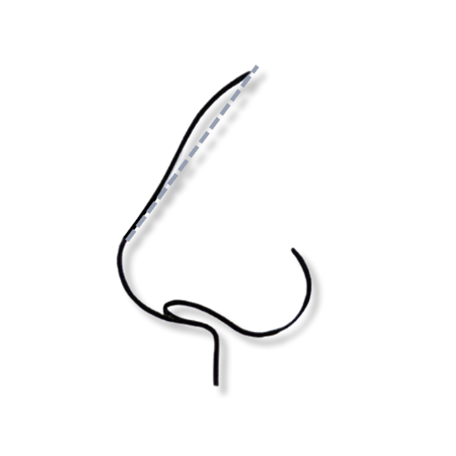 rinoplastia icono
